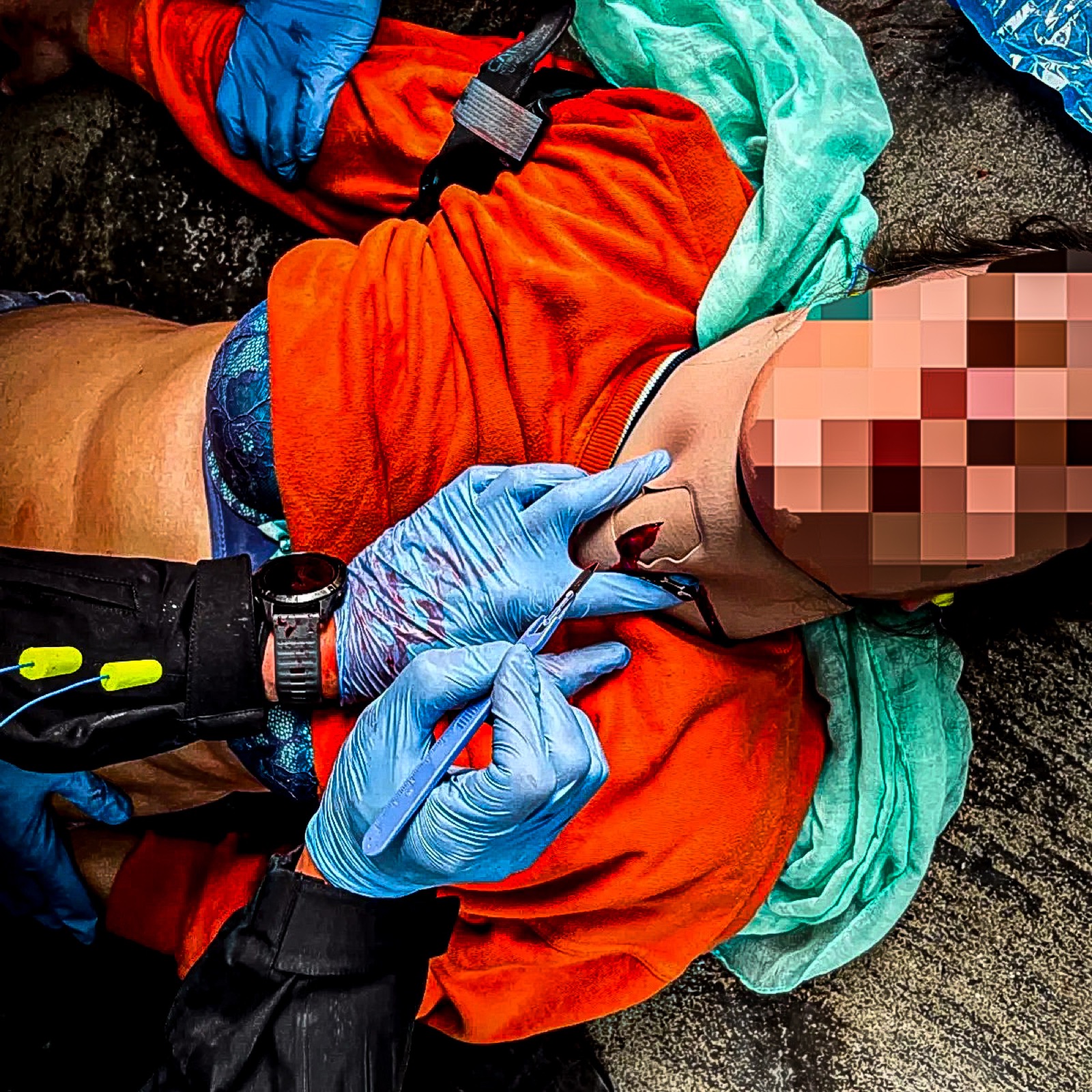 Beispielbild (Luftröhrenschnitt am Dummy)